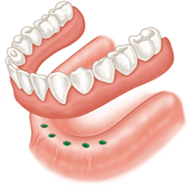 ottawa teeth whitening